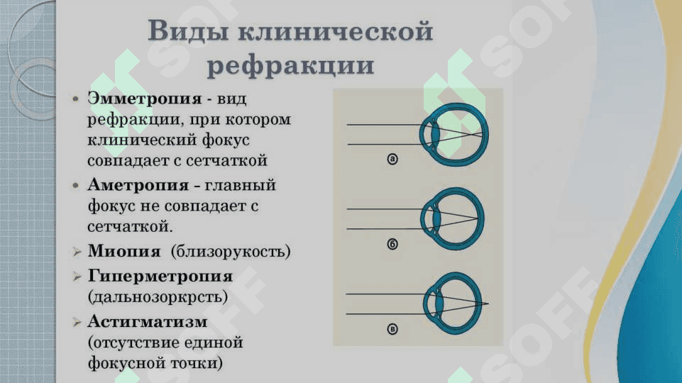 Klinik refraktsiya 3