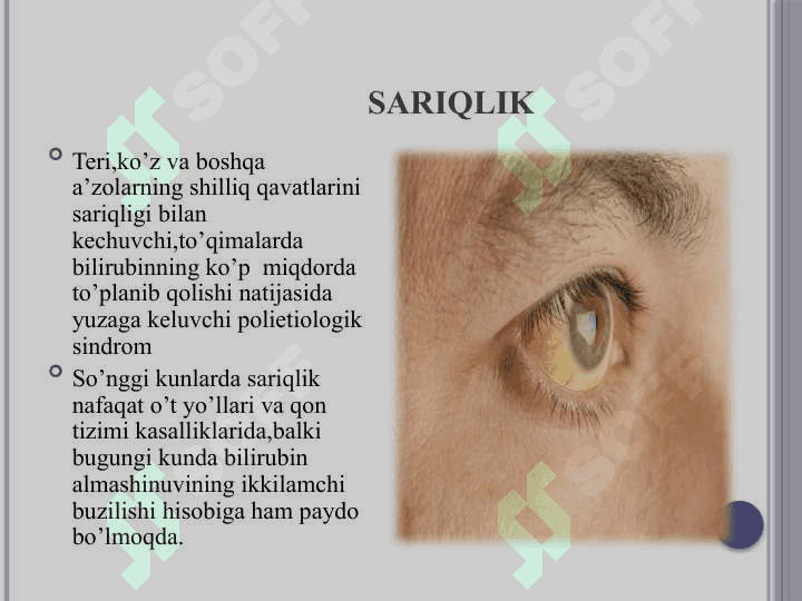 Sariqlik ikp 2