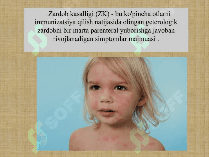 Zardob kasalligi 2
