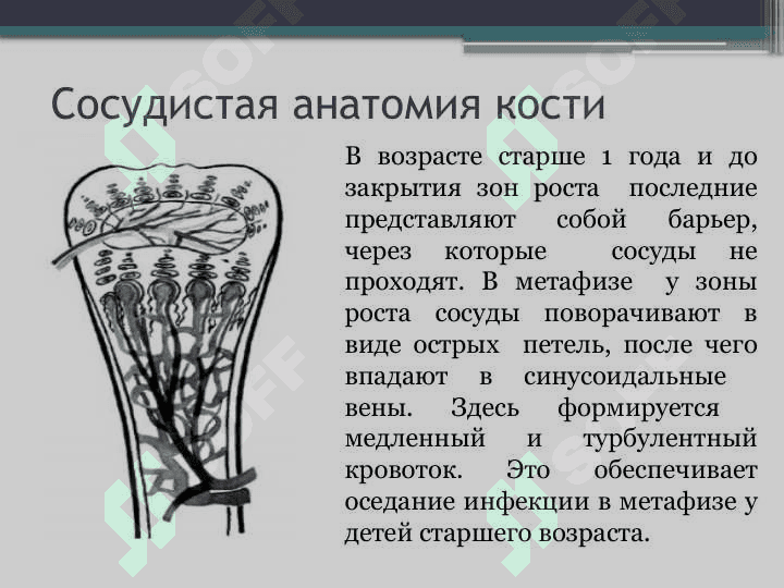 Острый гематогенный остеомиелит у детей 5