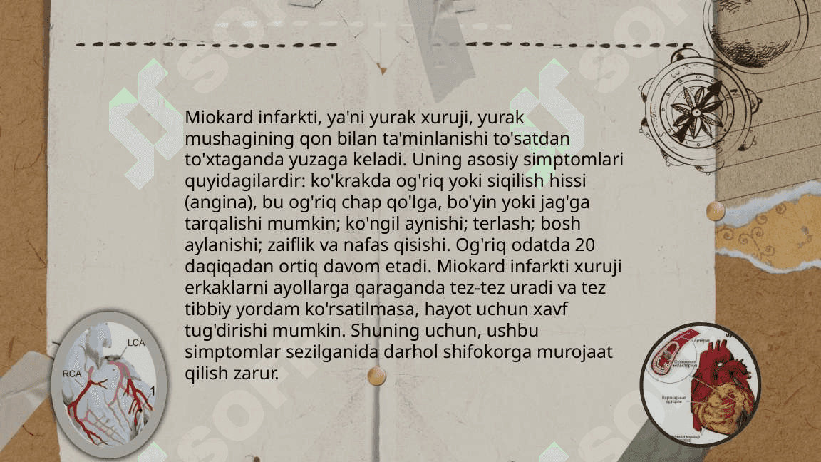 Miokard infarkti 3