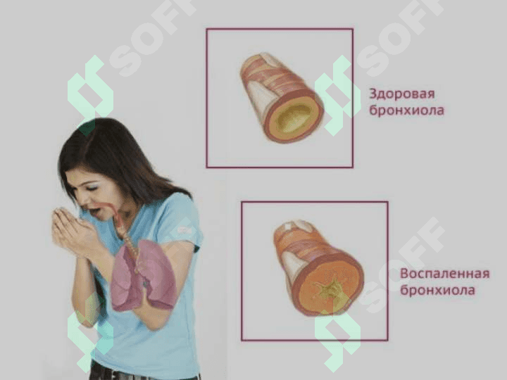 Respirator allergoz 4
