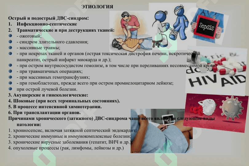 двс синдроми 6