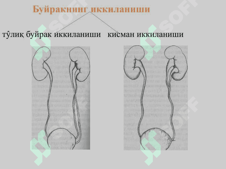 ЮКОРИ СИЙДИК ЧИКАРИШ ЙУЛЛАРИНИНГ TYFMA НУКСОНЛАРИ 5