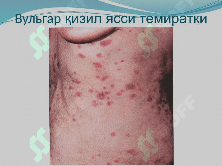 Qizil yassi temiratki . Қизил ясси темиратки 7