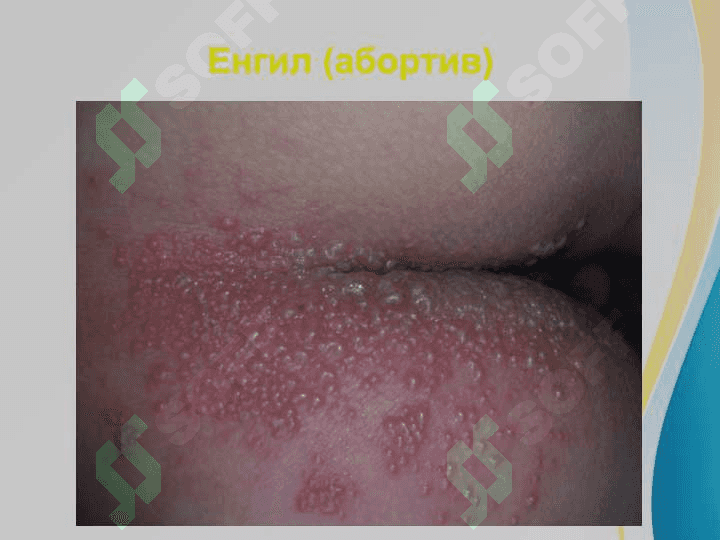O'rab oluvchi temiratki . Ўраб олувчи темиратки 7
