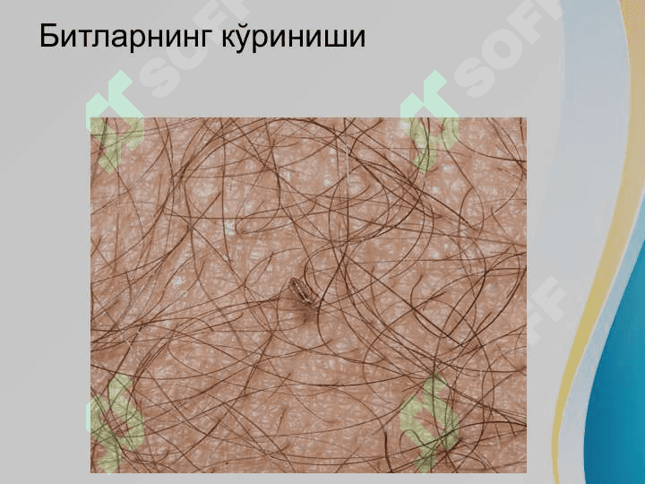Bitlash Pedikulyoz . Битлаш педикулёз 6