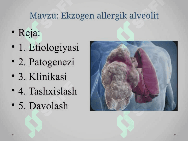 Ekzogen allergik alveolit 2