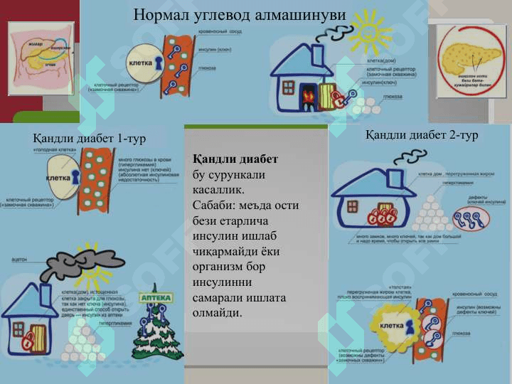 Қандли диабет нима? 5