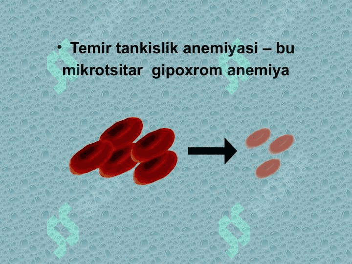 TEMIR TANQISLIK ANEMIYASI 5