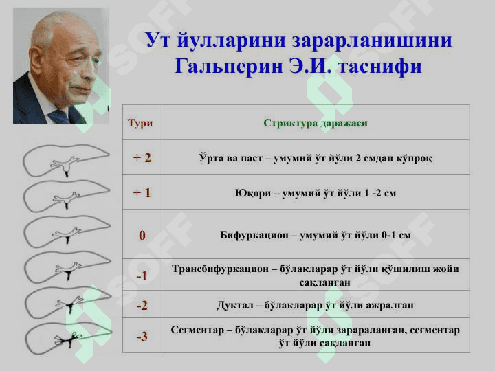 Механик сариқлик, постхолецистэктомик синдром 5