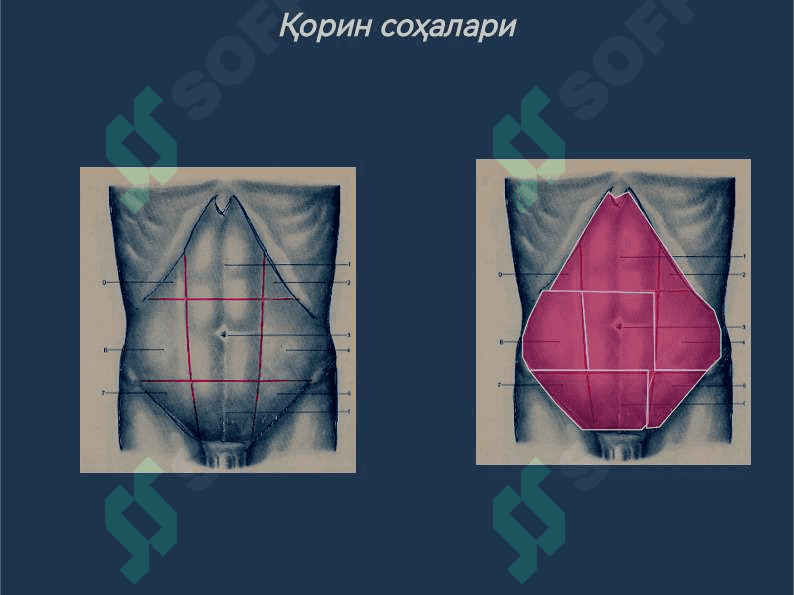 Гинекологик перитонитлар 4