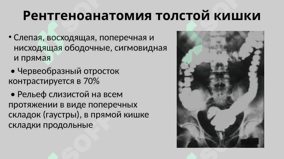 Рентгеноанатомия органов пищеварения и их пороки развития. Рентгеноанатомия зубов. Аномалии прикуса и развития зубов 8