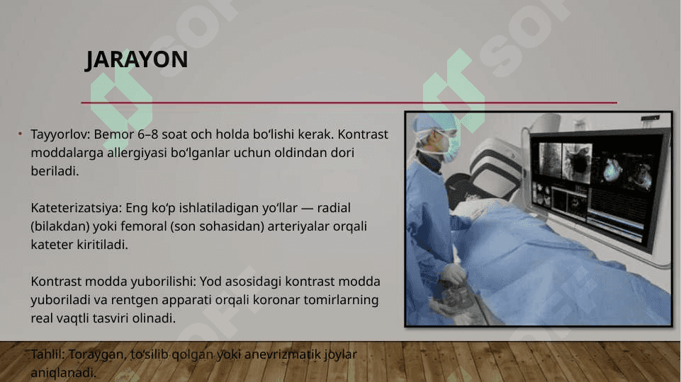 Koronarografiya 8
