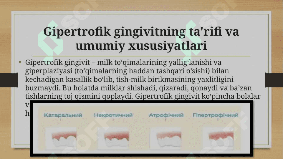 Gipertrofik gingivit 3