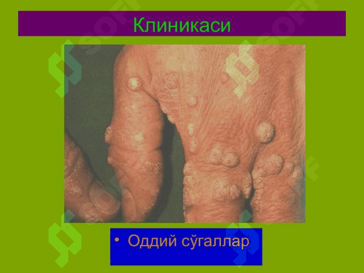 Терининг вирусли касалликлари 6