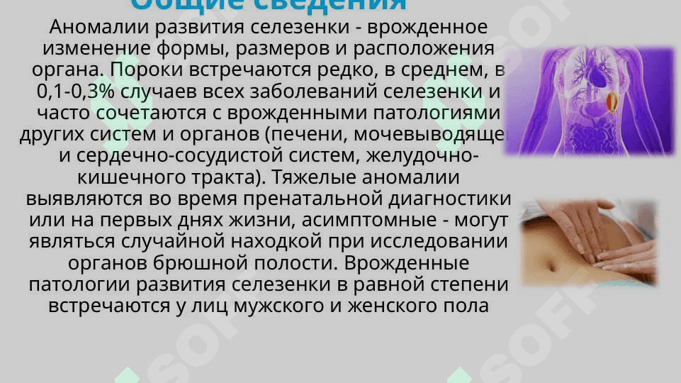 Аномалии развития селезенки 2