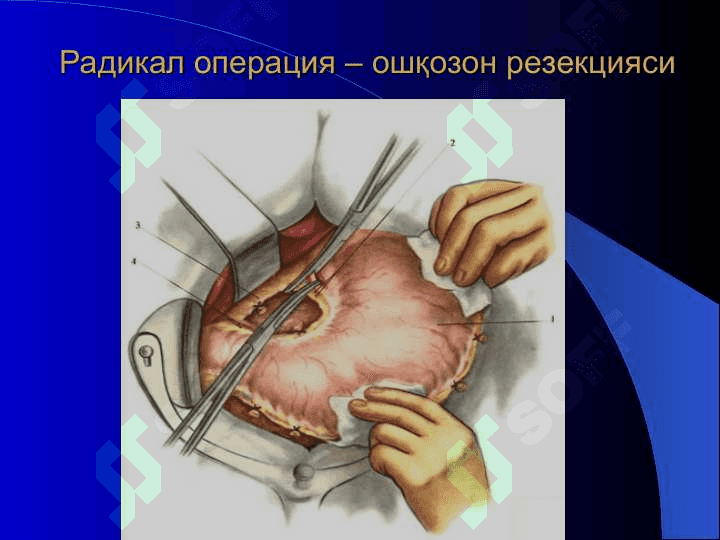 Хирургик операциялар 8
