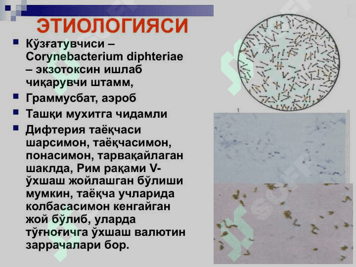 БЎҒМА – ДИФТЕРИЯ 3