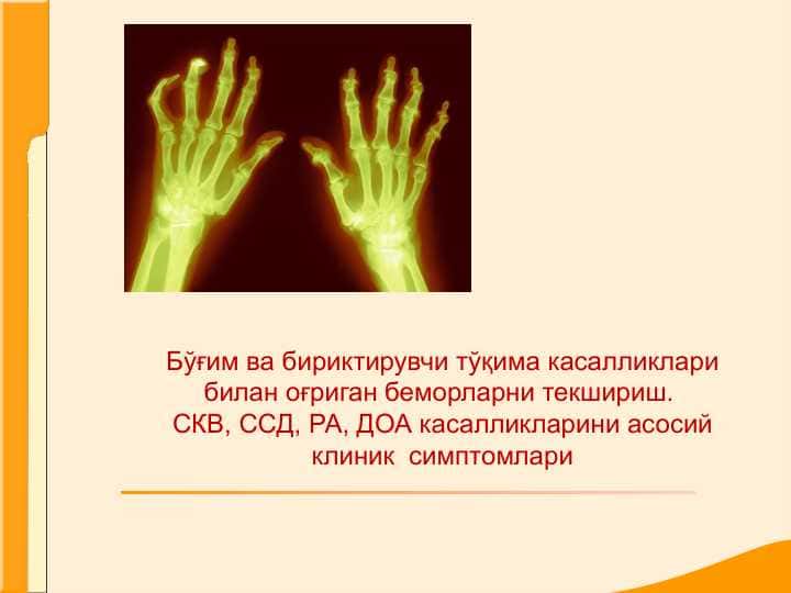 Бўғим ва бириктирувчи тўқима касалликлари билан оғриган беморларни текшириш. СКВ, ССД, РА, ДОА касалликларини асосий клиник  симптомлари