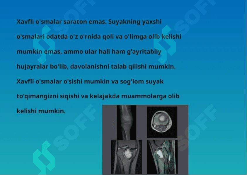 suyak to'qimasini o'smasi 3