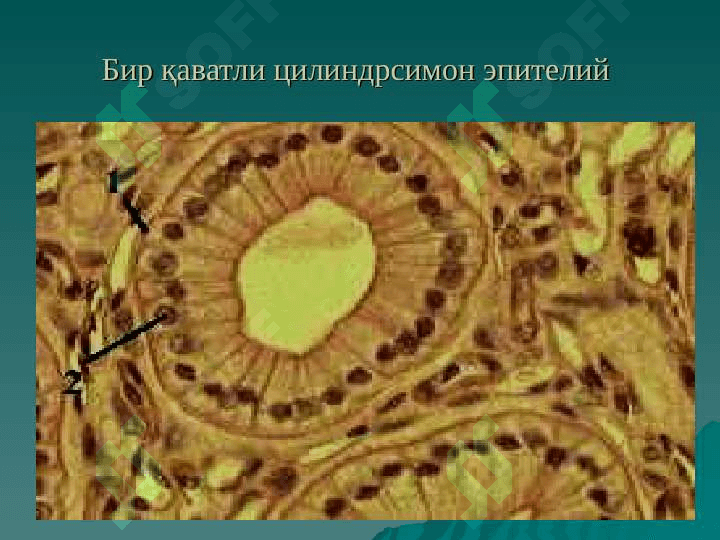 ЭПИТЕЛИЙ ТЎҚИМАСИ 6