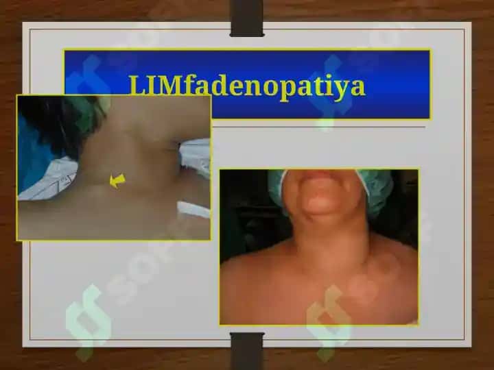 OIV INFEKTSIYASI 7