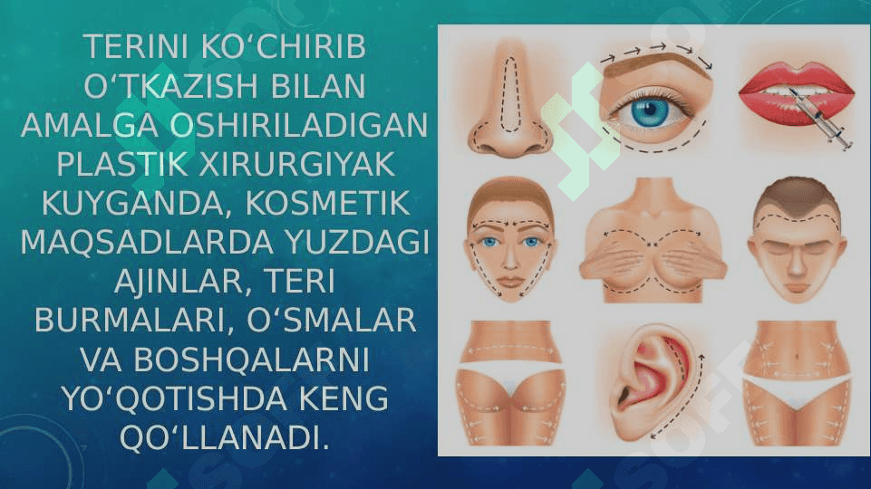 Yuzdagi plastik operatsiyalar xususiyatlari 3