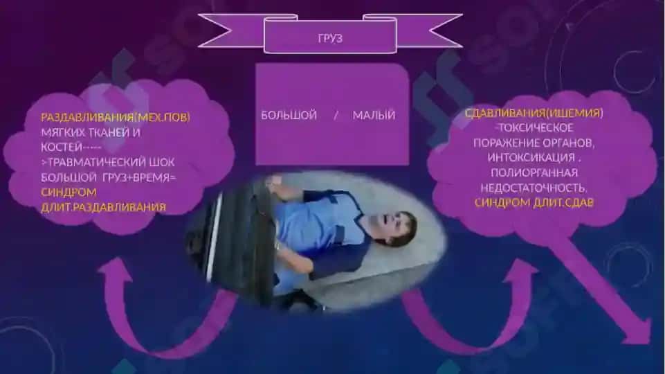 Синдром длительного сдавления (СДС) 3