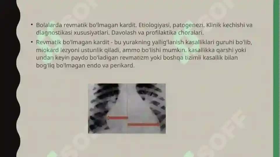BOLALARDA REVMATIK BO`LMAGAN KARDIT 3