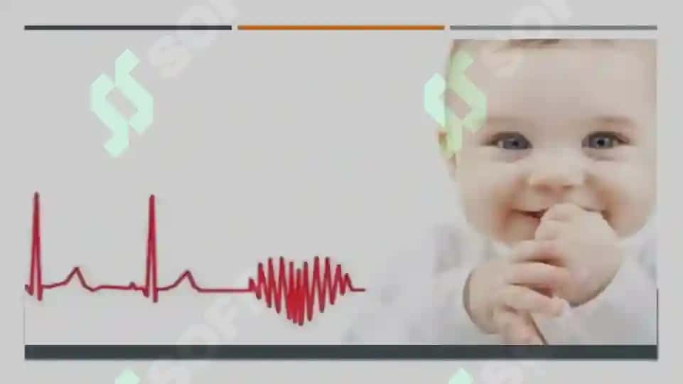 PEDIATRIYA  NOREVMATIK KARDIT 2