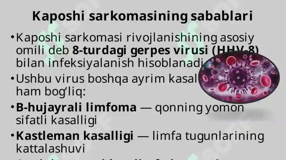 Kaposhining sarkomasi. 4