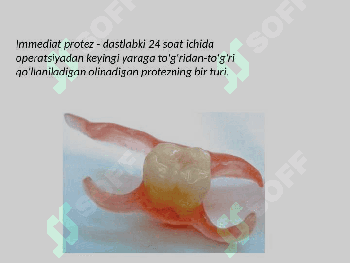 Immediat protezlar 2
