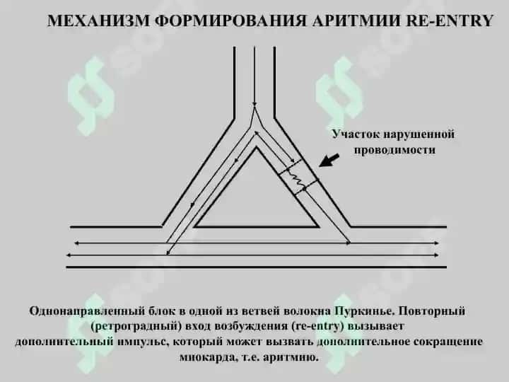 Противоаритмическое средство 8