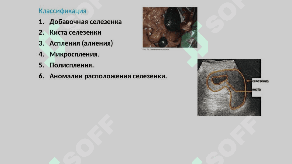 Taloq tug'ma nuqsonlari 4