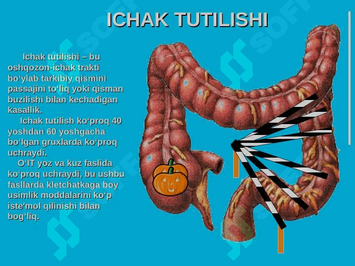 O`tkir ichak tutilishlari 5