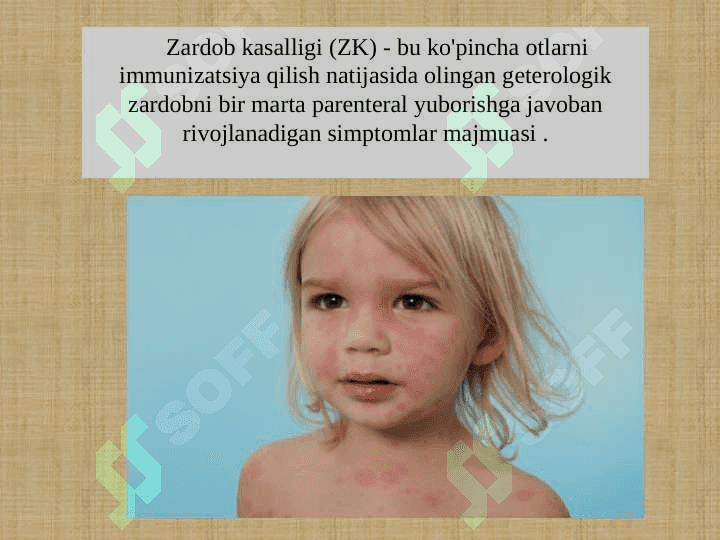 Zardob kasalligi 2