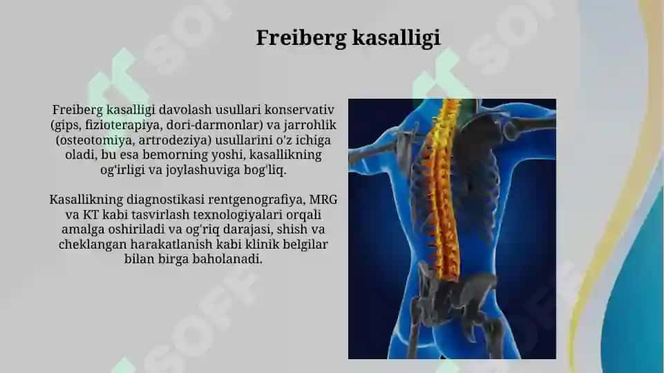 Osteoxandropatiyalar. Skolioz 6
