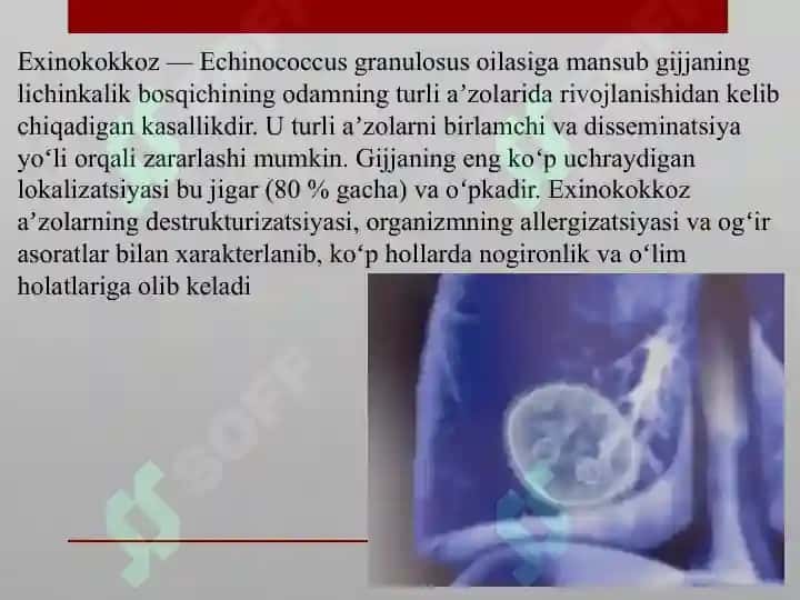 Exinakokk kasalligi 2