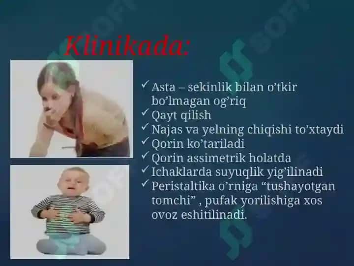 Orttirilgan o’tkir ichak tutilishi 8