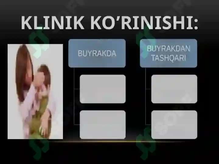 O’tkir glomerulonefrit 5