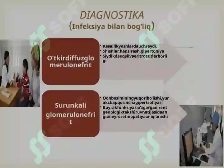 O’tkir glomerulonefrit 8
