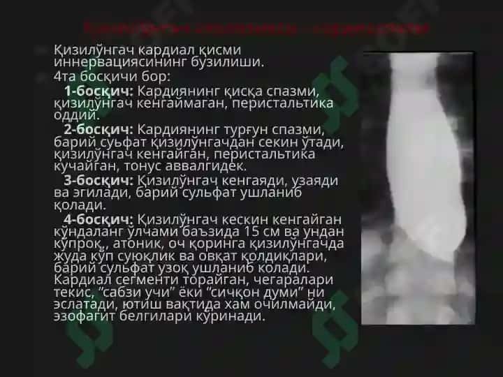 Қизилўнгач 5