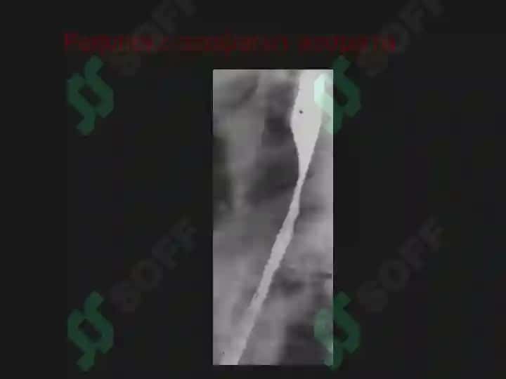 Қизилўнгач 6