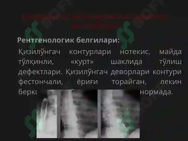 Қизилўнгач 8