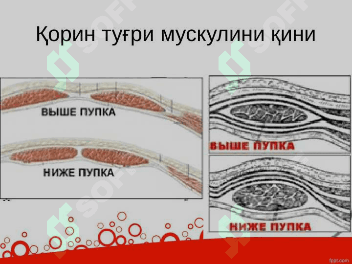 Қорин олд ён девори 4