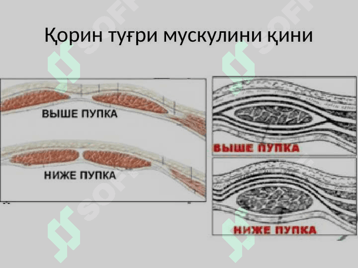 Қорин олд ён девори топографияси 4