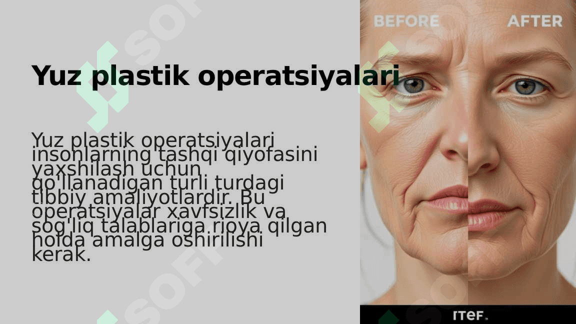 Yuz plastik operatsiyalari 2