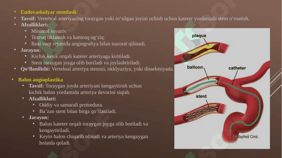 Vertebral arteriyada zamonaviy operatsiyalar 3