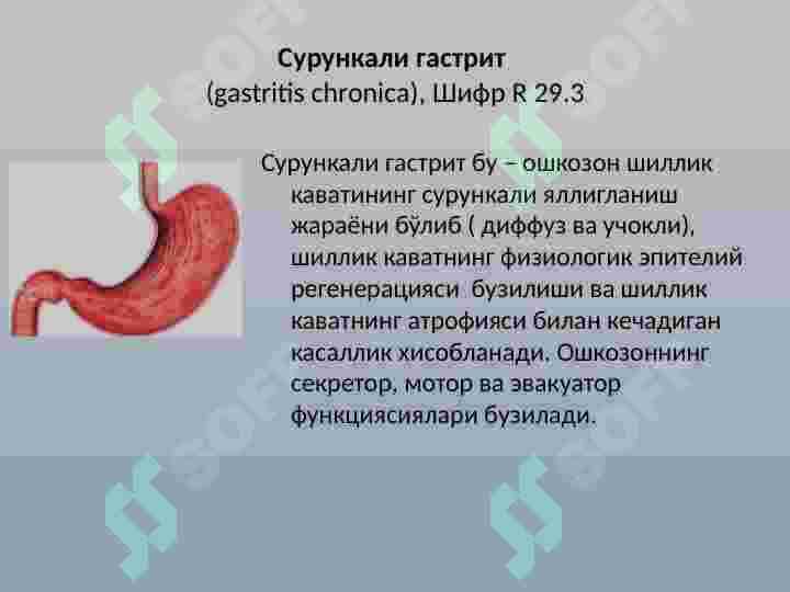 SURUNKALI GASTRIT 7
